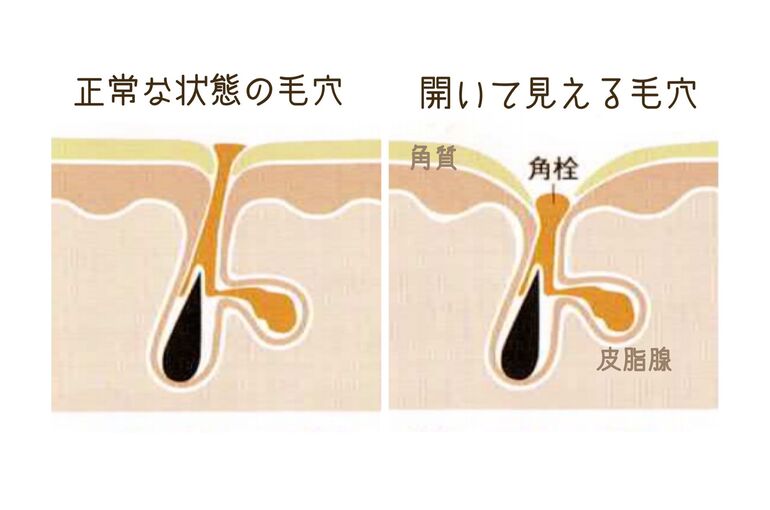 S__62775326