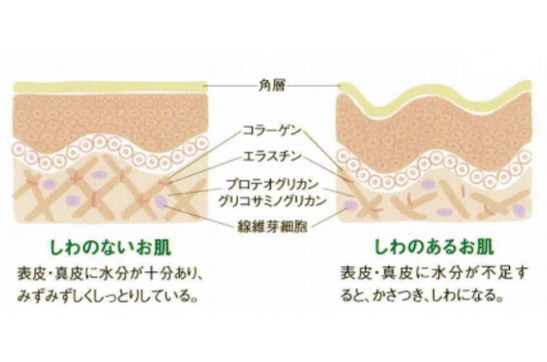 しわ